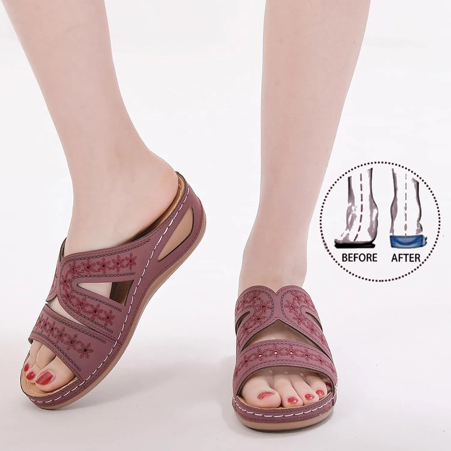 Slide Sandals Women Orthopedic Casual Wedge Slipper Sandals Fashion Cutout Flower Design Walking Shoes Lightweight Non-Slip Summer Beach Slippers